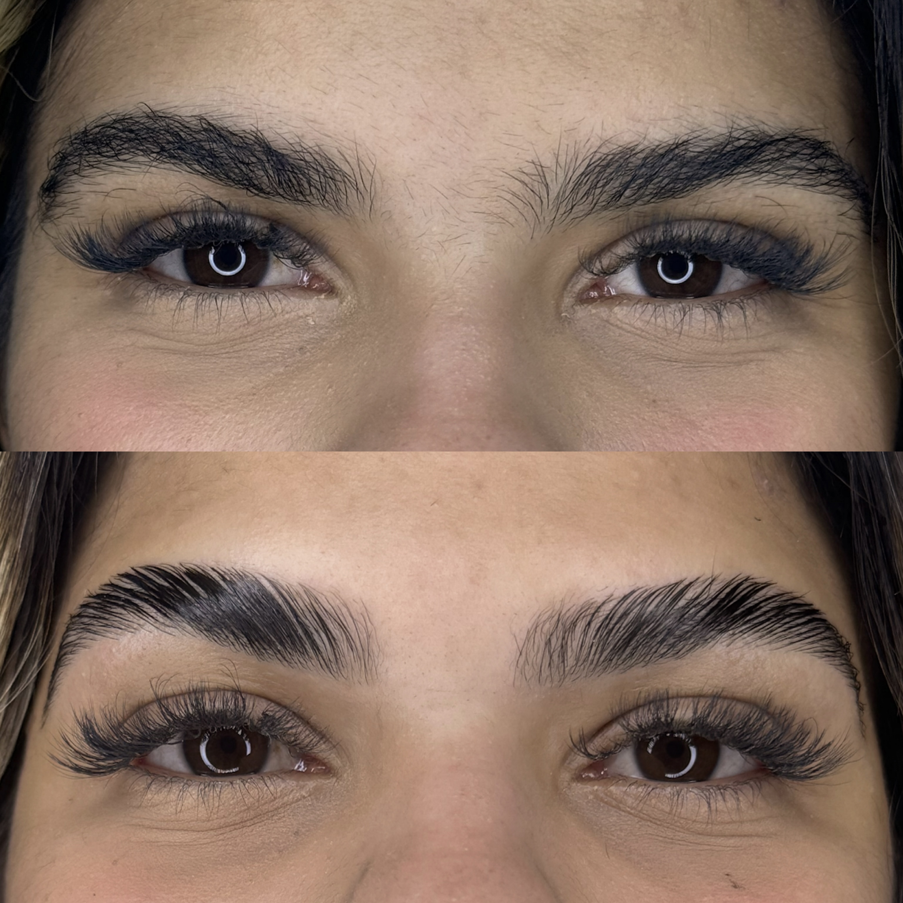 Resultado de tratamento - Antes e Depois